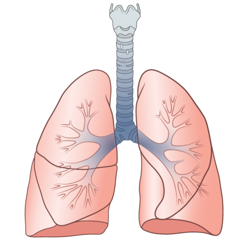 Sarcoid Lung Disease - Family Allergy